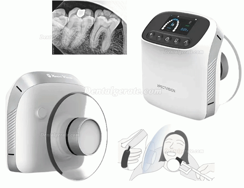 Handgehaltenes Dental R&ouml;ntgenger&auml;t, Mobile Hochfrequenz R&ouml;ntgenger&auml;t XVbeam2000